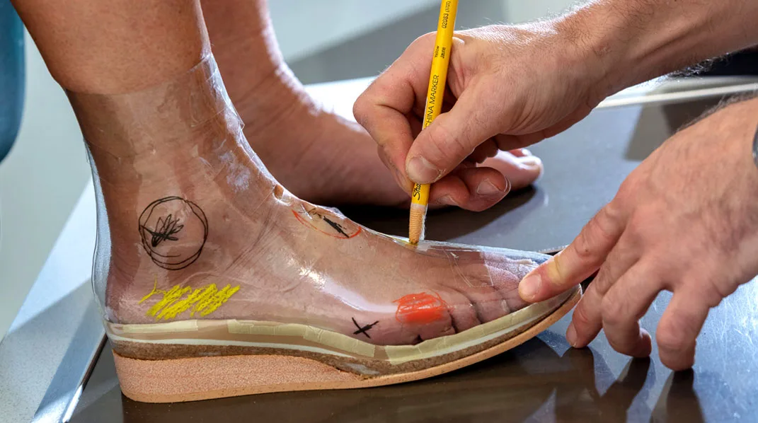 Il tecnico segna con una matita i punti di riferimento sulla forma del piede del paziente